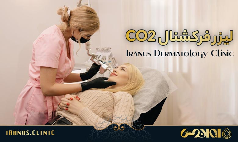 لیزر فرکشنال CO2