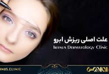 علت اصلی ریزش مو