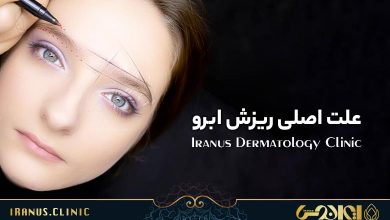 علت اصلی ریزش مو