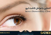 آشنایی با مراحل کاشت ابرو