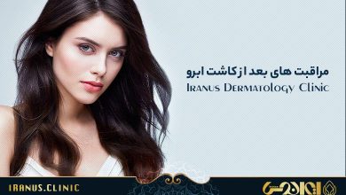 مهمترین مراقبت های بعد از کاشت ابرو