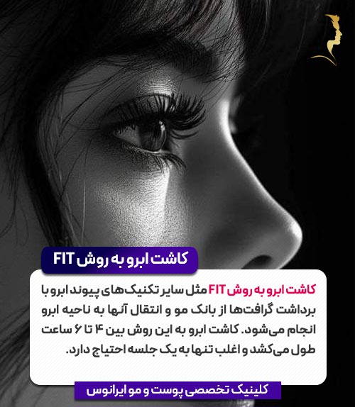 کاشت ابرو به روش FIT