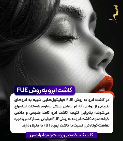 کاشت ابرو به روش FUE