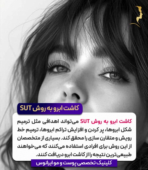 کاشت ابرو به روش SUT