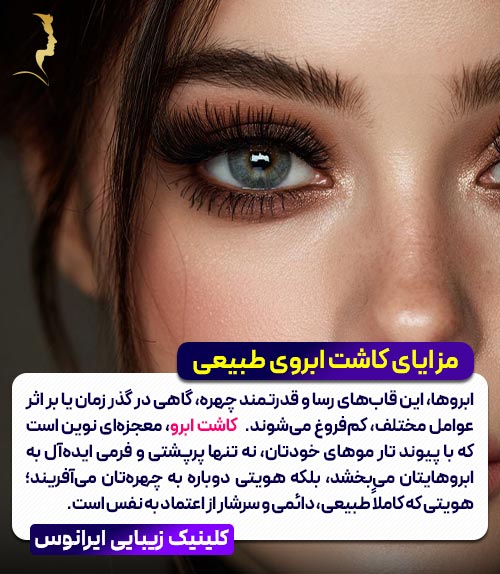 کاشت ابرو چیست ؟