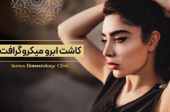 کاشت ابرو به روش میکروگرافت