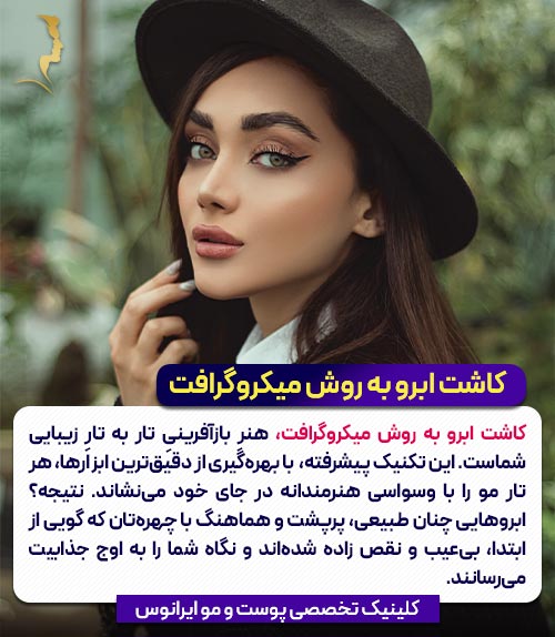 کاشت ابرو به روش میکروگرافت