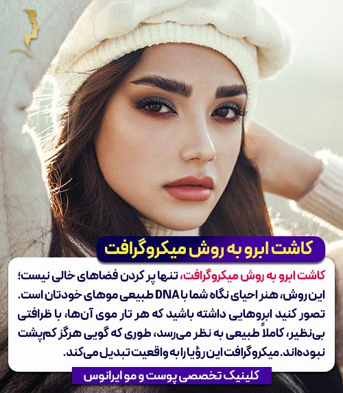 مزیت کاشت ابرو به روش میکروگرافت