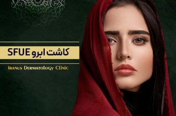 کاشت ابرو به روش Super fue