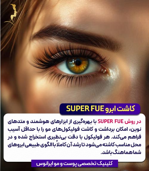 مزایای کاشت ابرو به روش SUPER FUE